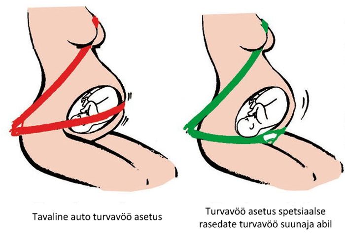 Turvavyön suuntaaja raskaana oleville BE SAFE kuvasuurennos